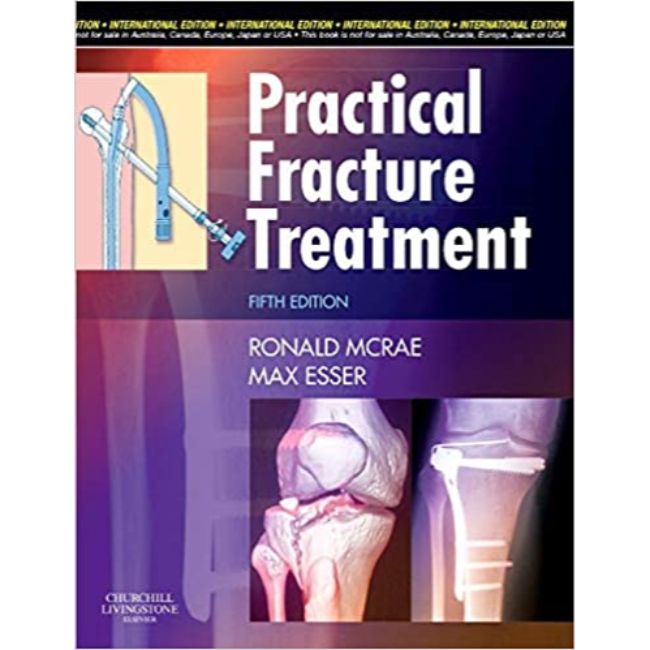 Practical Fracture Treatment, International Edition, 5ed BY R. McRae, M. Esser