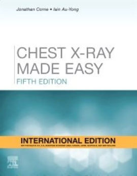 Chest X-Ray Made Easy, International Edition, 5ed BY J. Corne, M. Kumaran